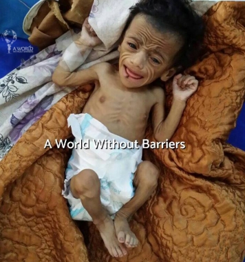 Help for Yemen